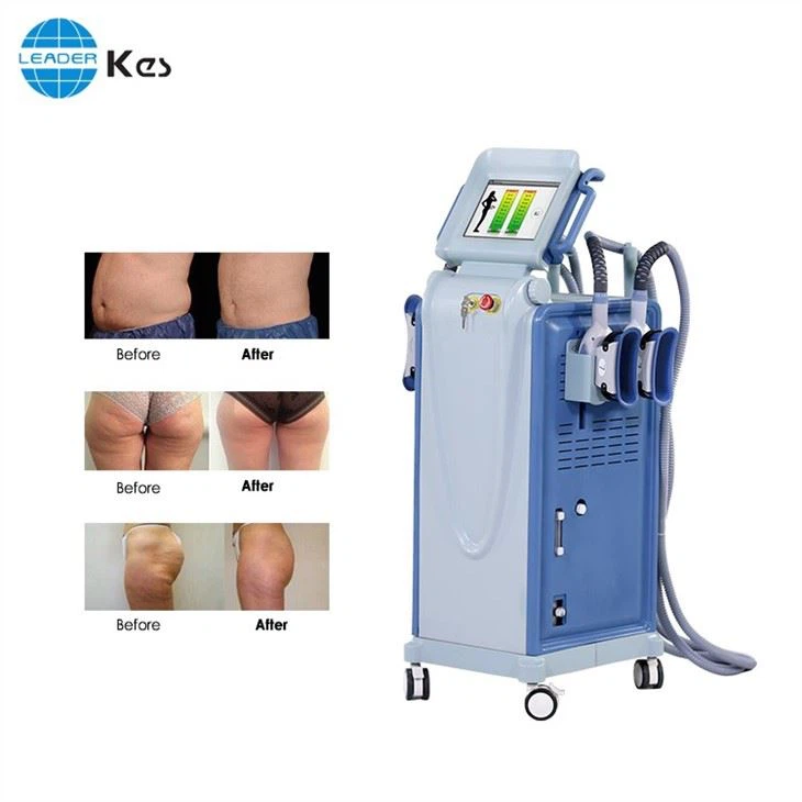 Frozen Weight Loss Slim8